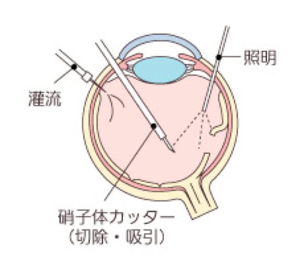 眼球断面図2